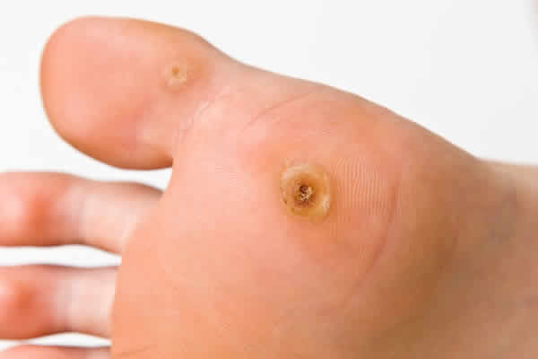 black bottom foot spot Sluts with red pubic hair