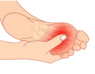 plantar fasciitis treatments