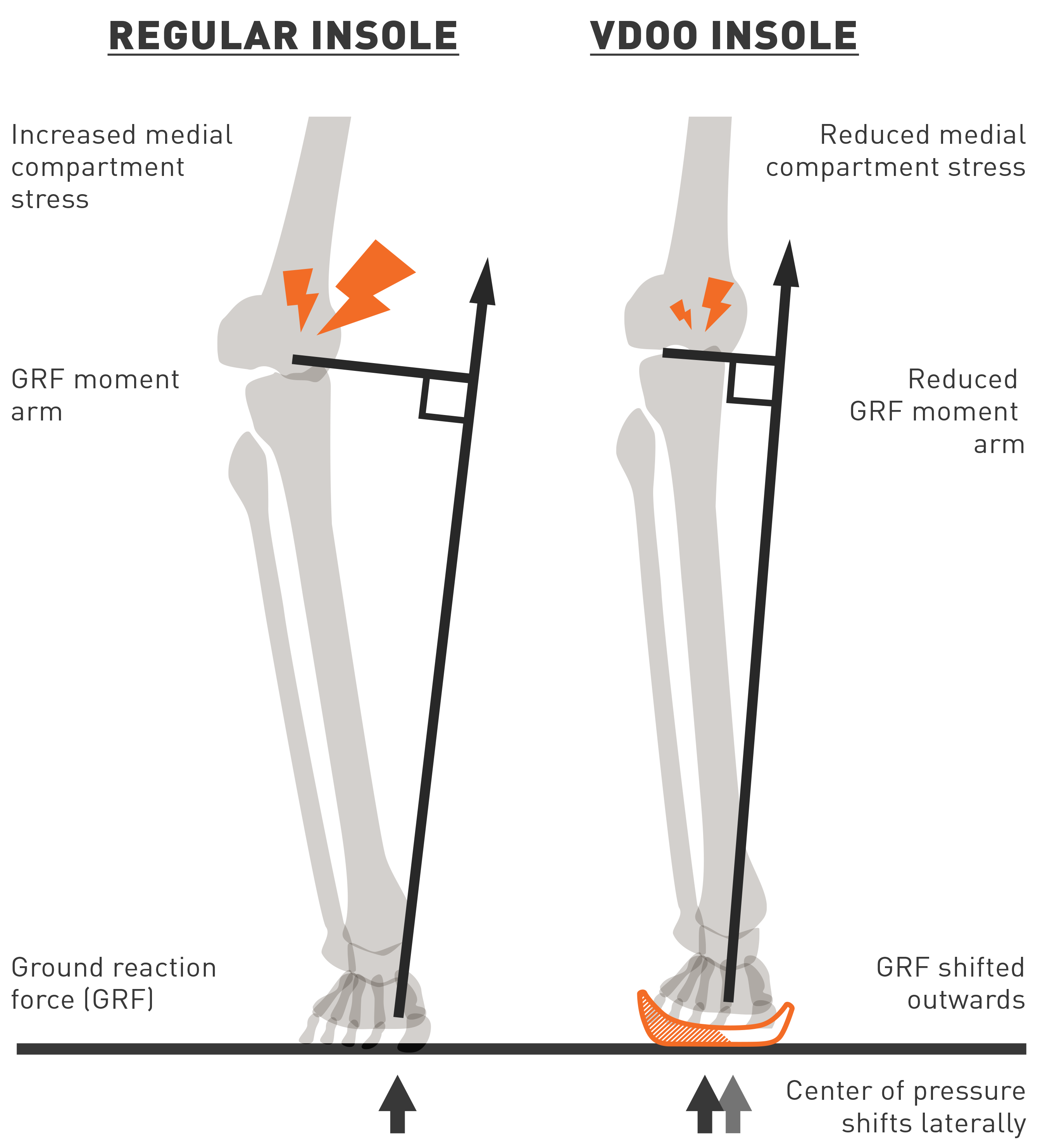 Could An Insole Be As Effective As A Knee Brace Kintec